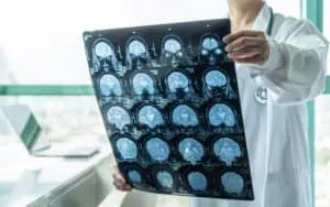 Non-Surgical Neurological Treatments