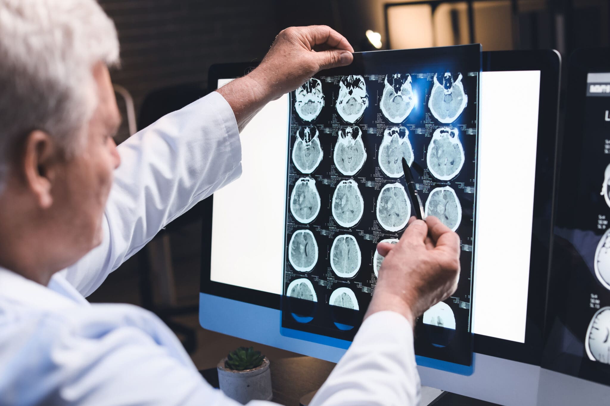 TBI, Concussion & Head Injuries