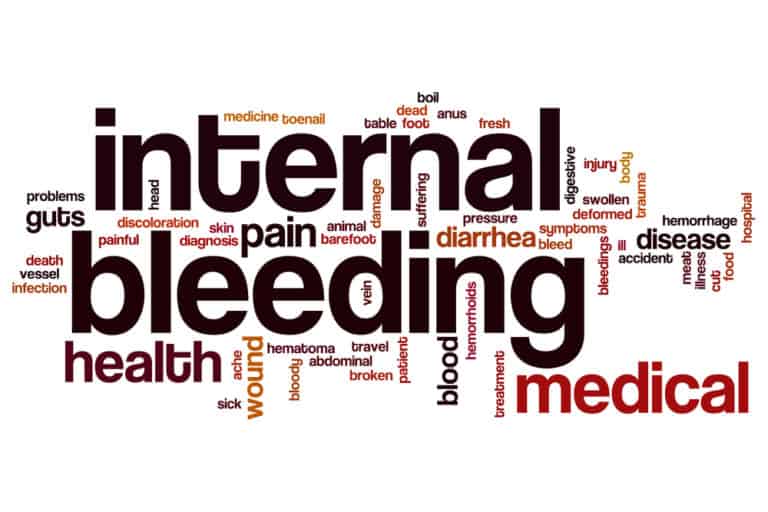 How Do You Know if You’re Bleeding Internally After a Car Accident?